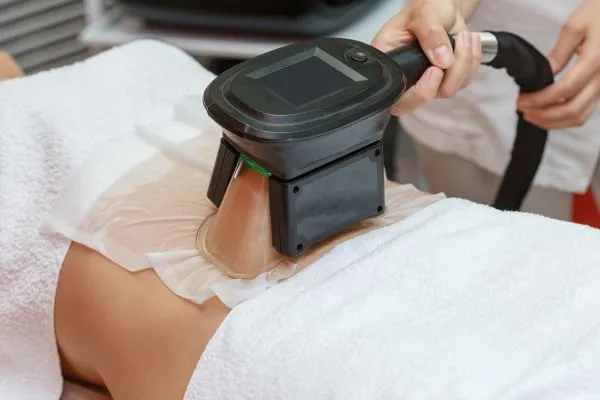 Image of person having fat freezing treatment to help weight gain Portsmouth
