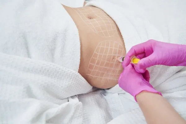 image of fat dissolving injections on love handles to help combat weight gain Portsmouth