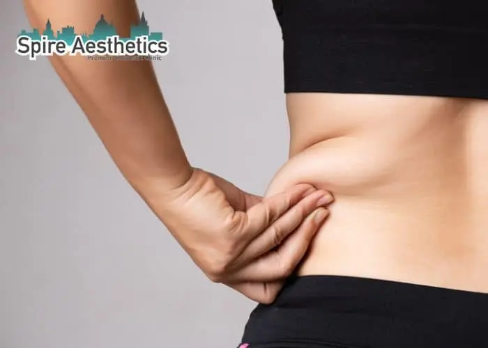 Image of woman pinching fat on their hips Portsmouth. Fat Freezing treatment