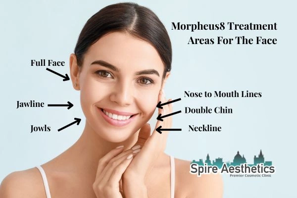 Where can Morpheus8 Treatment Portsmouth be done on the body?