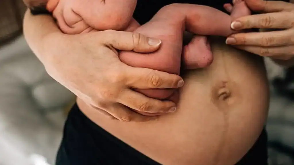 Why Is My Stomach Still Big After Pregnancy Portsmouth?