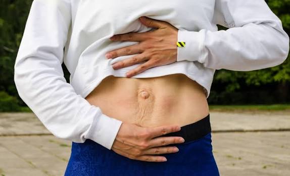 When Could Diastasis Recti Be the Missing Piece of the Puzzle Portsmouth?